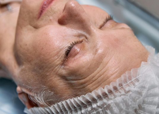 Chirurgie du visage : découvrez les tendances actuelles